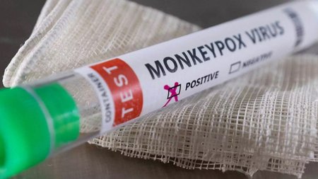 monkeypox_fialidia_reuters2-scaled