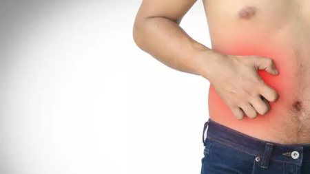 man-hand-scratching-an-itch-picture-id1092206158-666x399 (1)