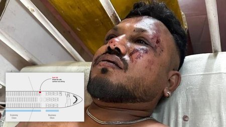 xrwma-india-survivor