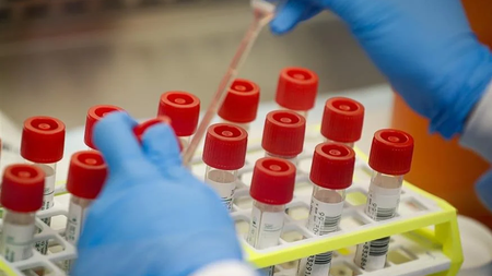 365486e8-32df-45c9-9fa5-6d5fb15cdde5