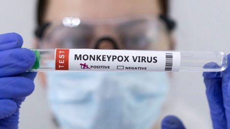 HKUP6QPJT5I2JMT6ZBKKT5SOCA-1024x682